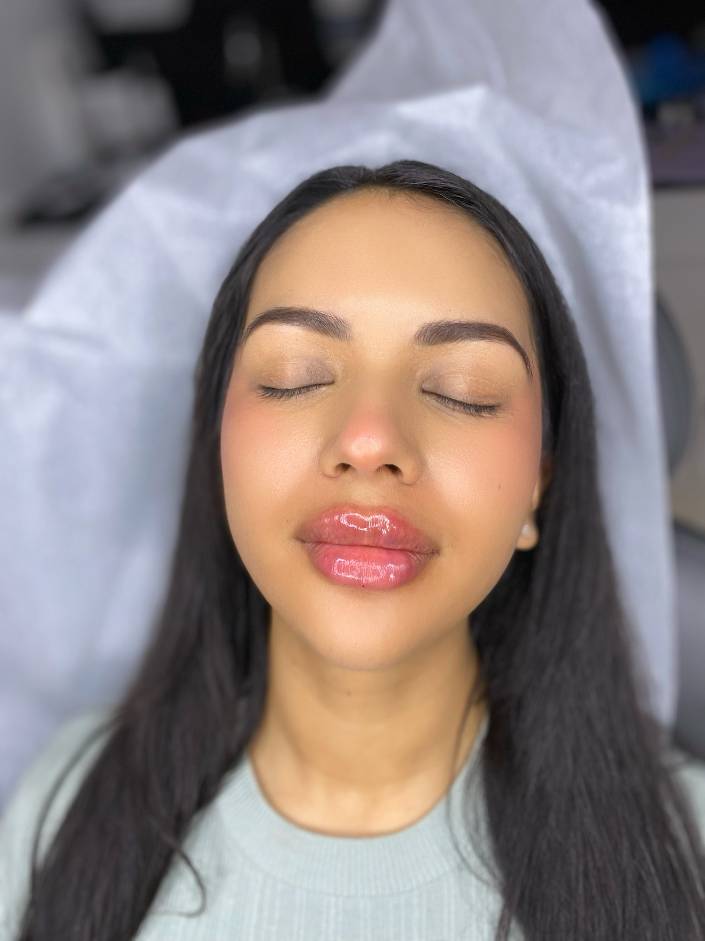 Lip Filler Full Syringe