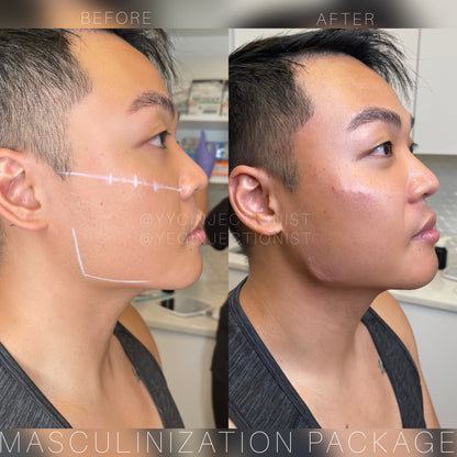 6ML Masculinization Package