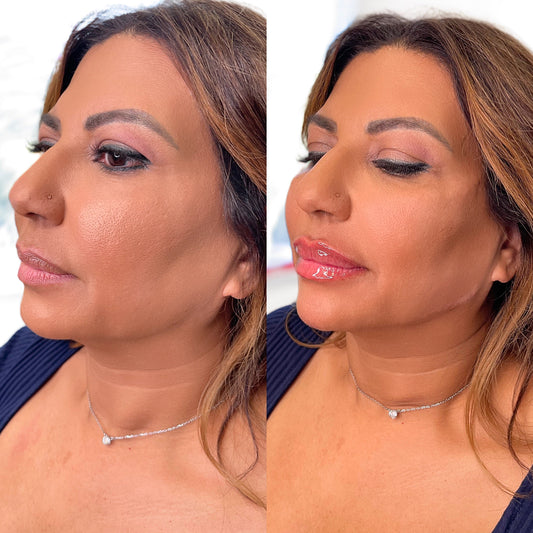 6ML Full Glam Package