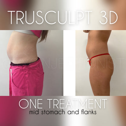 Trusculpt - 45% OFF