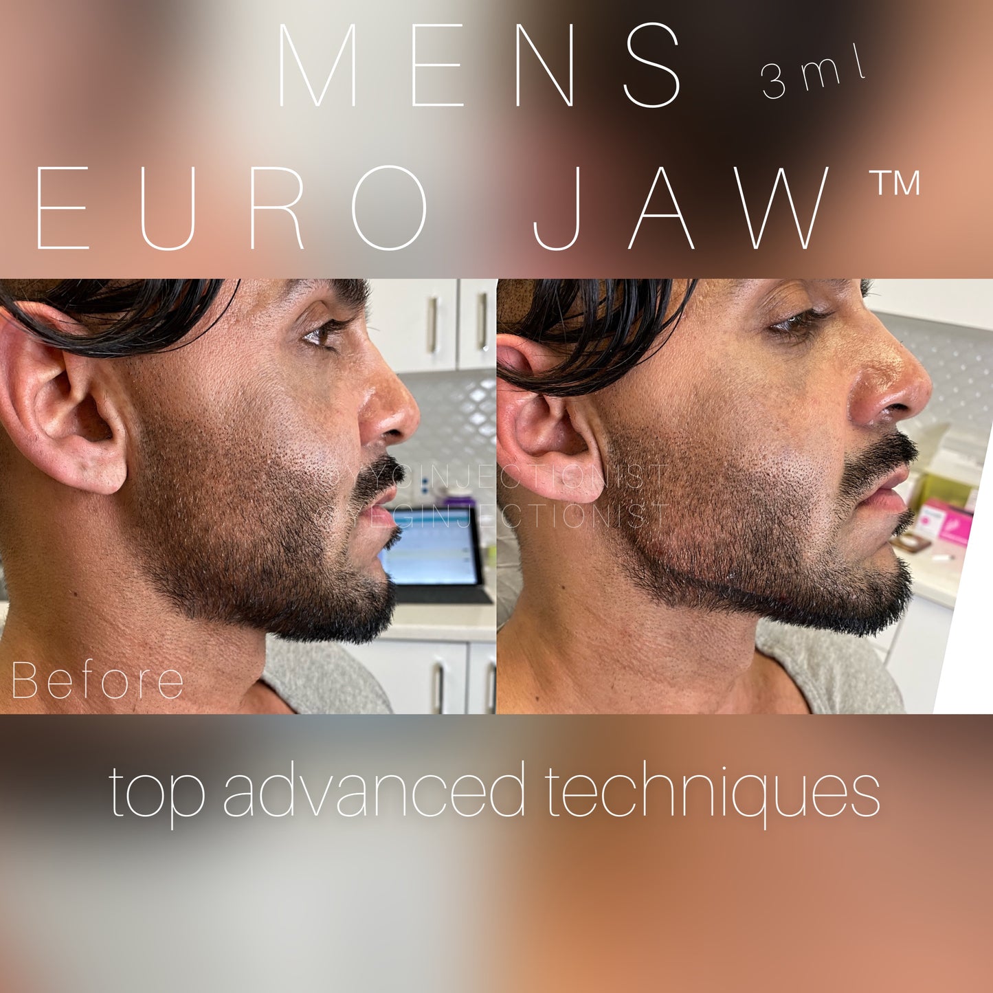 6ML Masculinization Package