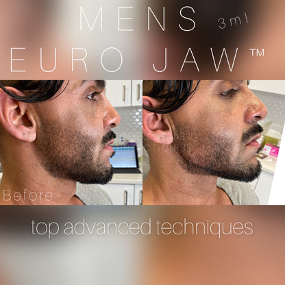 6ML Masculinization Package