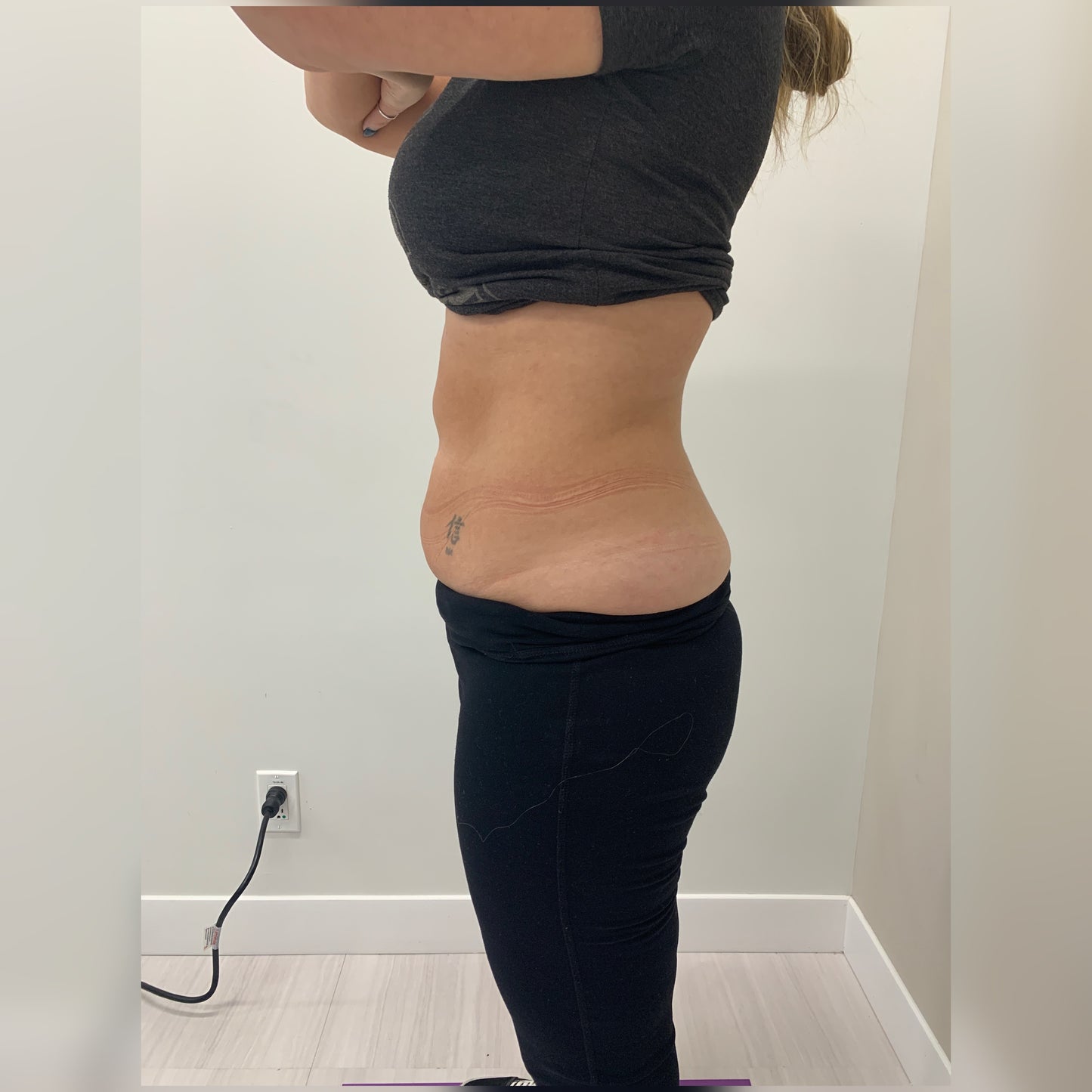 Trusculpt - 45% OFF