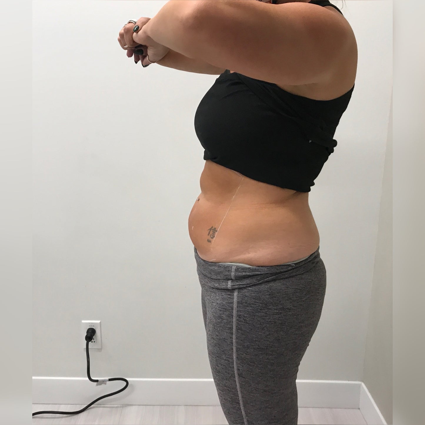 Trusculpt - 45% OFF