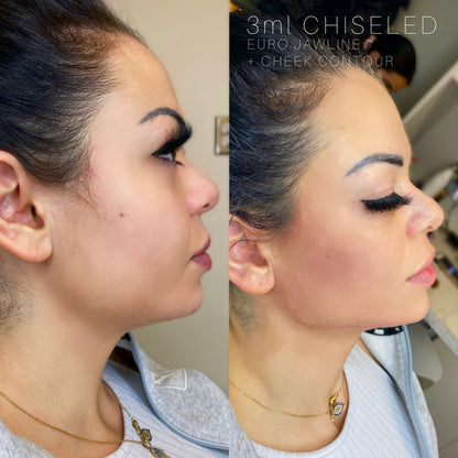3ML Chiseled Package