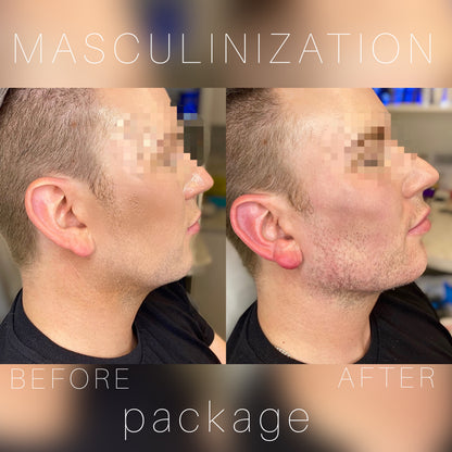 6ML Masculinization Package