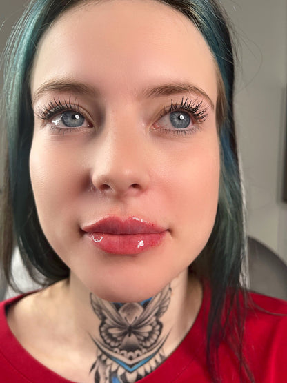 Lip Filler Full Syringe