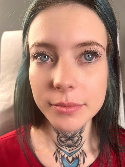 Lip Filler Full Syringe
