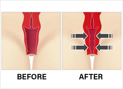 Vitalia Vaginal Rejuvenation