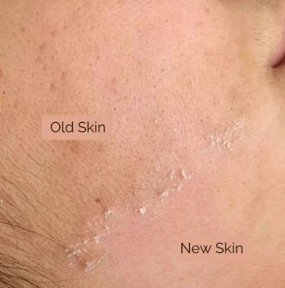 Dermaplaning Facial: BUY 2 GET 1 FREE
