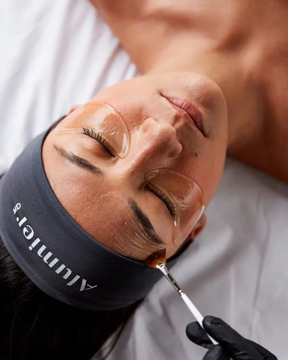Chemical Peels 20% OFF!