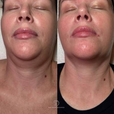 Peptide Facial Refining Concentrate