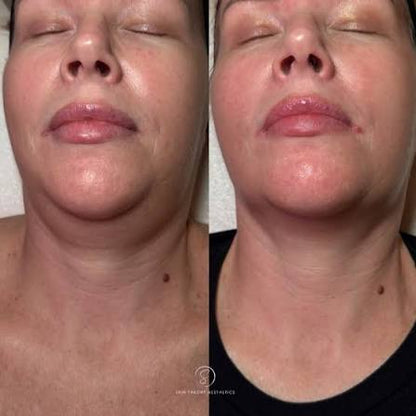 Peptide Facial Refining Concentrate