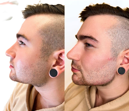 6ML Masculinization Package