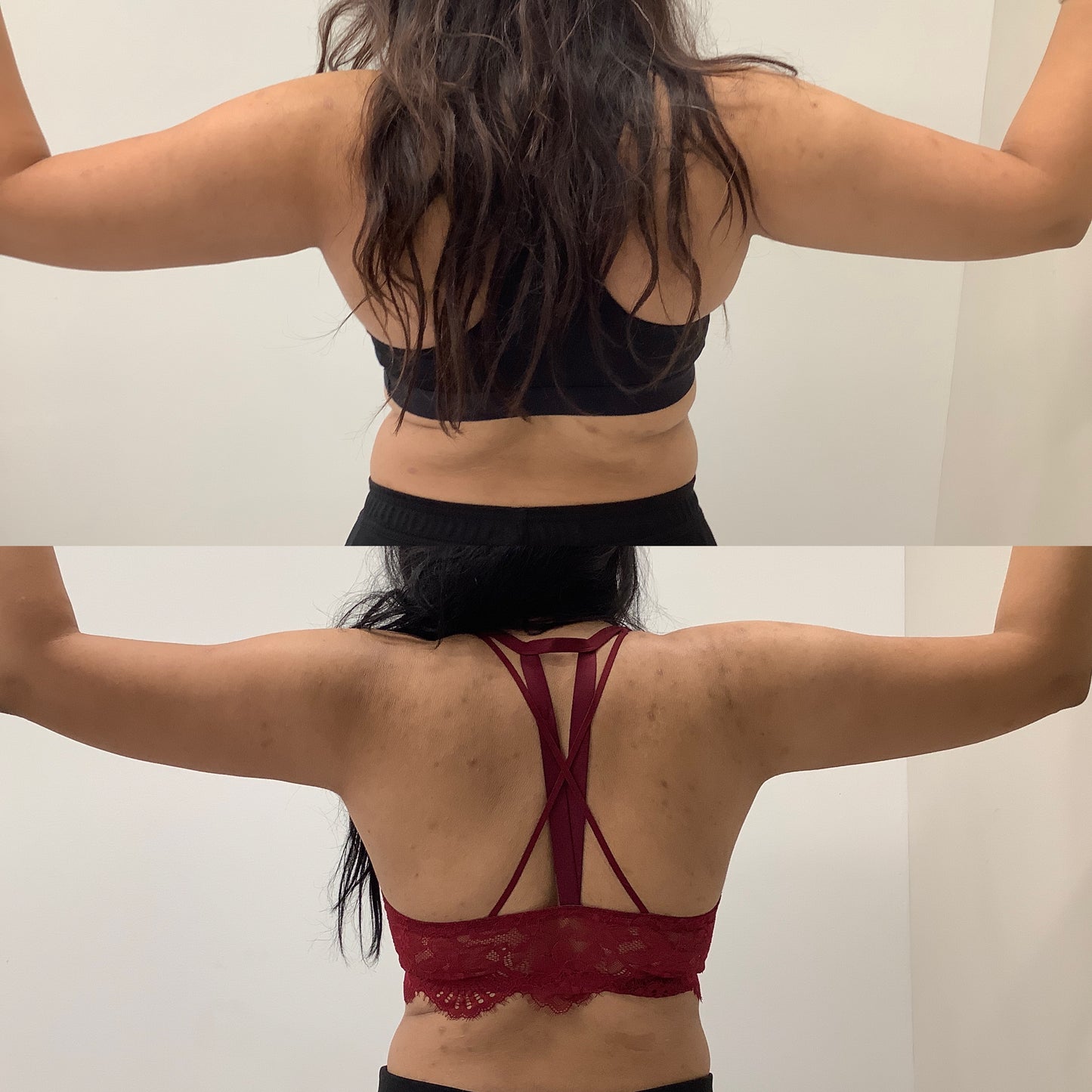 Trusculpt - 45% OFF