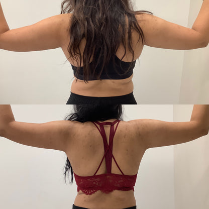 Trusculpt - 45% OFF